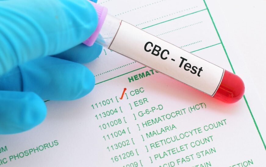 CBC Test Explained: Meaning, Normal Range, Uses & How to Read Your Report