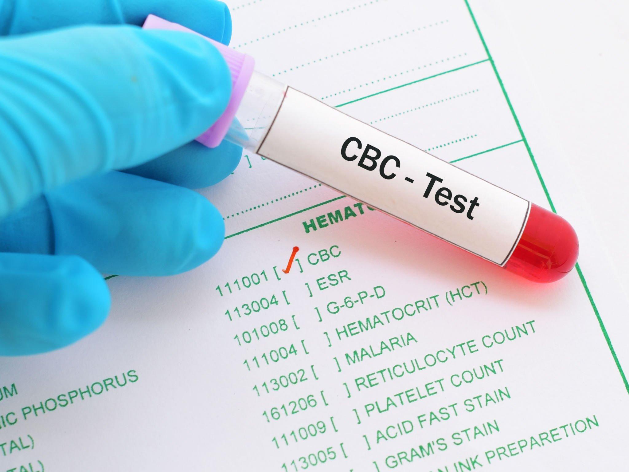 CBC Test Explained: Meaning, Normal Range, Uses & How to Read Your Report