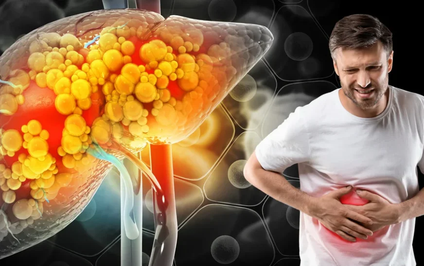 Early Signs of Fatty Liver: Symptoms You Should Never Ignore