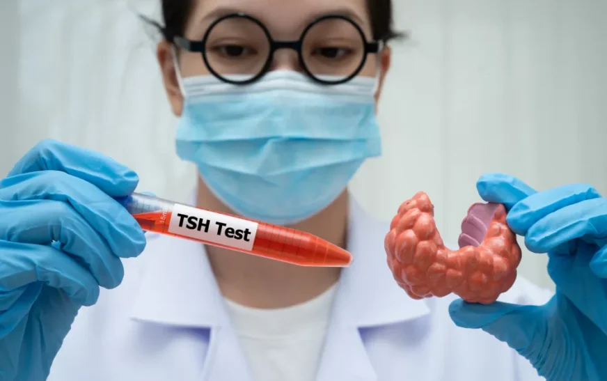 Is It Your Metabolism or Your Thyroid? How to Read a T3, T4, and TSH Blood Test