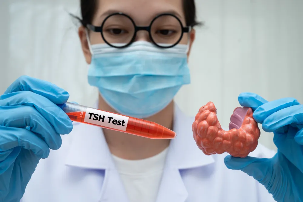 Is It Your Metabolism or Your Thyroid? How to Read a T3, T4, and TSH Blood Test