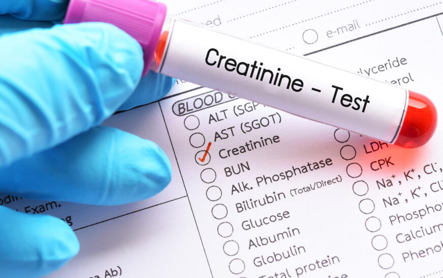 Creatinine Blood Test: Normal Range, Causes of High Levels