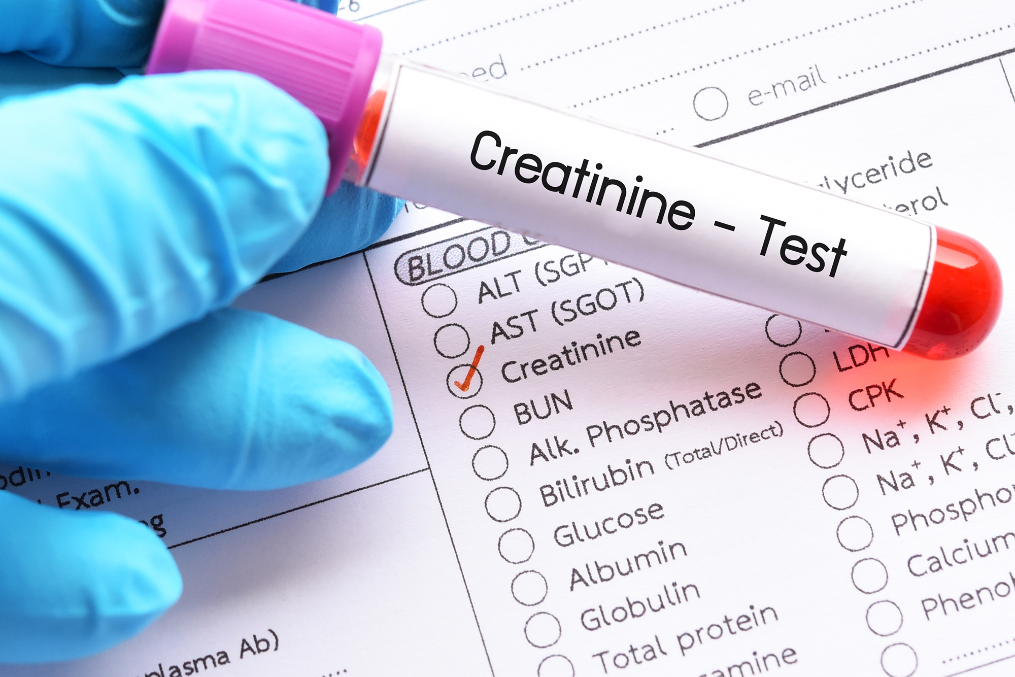 Creatinine Blood Test: Normal Range, Causes of High Levels