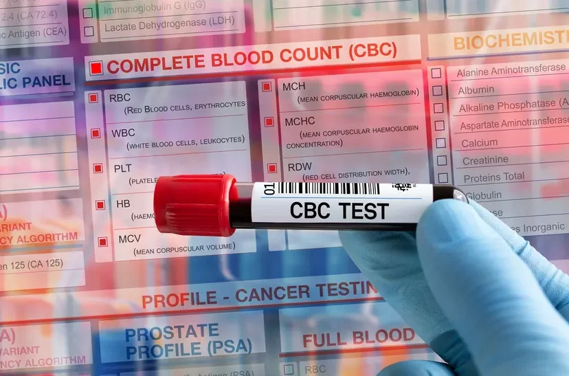 Demystifying Your CBC Report: What Do Low Hemoglobin and Platelets Really Mean?
