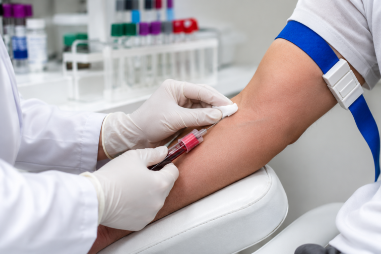 Healthcare professional collecting a blood sample for a creatinine blood test to evaluate kidney function.