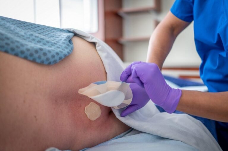 Bed sores treatment with professional wound dressing and infection assessment