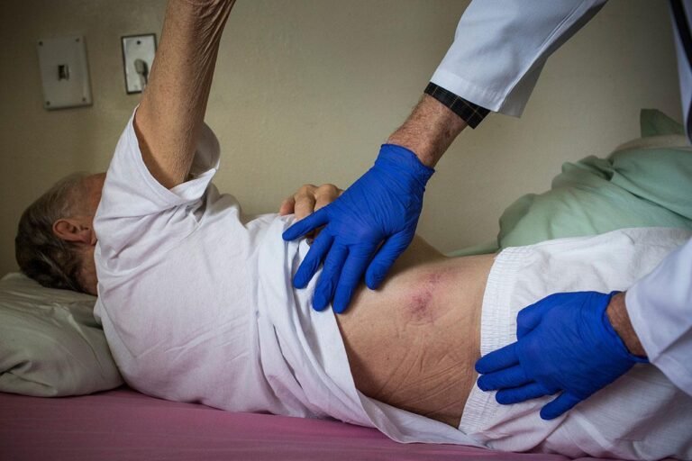 Bed sores treatment and wound healing considerations for diabetic patients